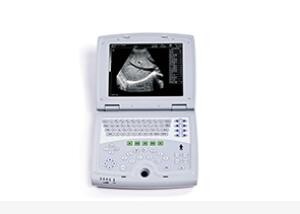 China Mobile Ultrasound Machine Digital Laptop Ultrasound Scanner with 100 Frames Permanent Storage wholesale