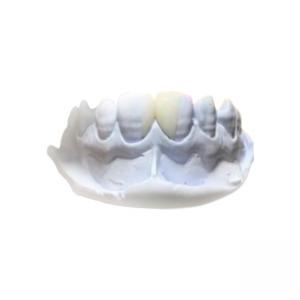 China Efficient Resin Removable PFM Dental Crown Health Materials wholesale