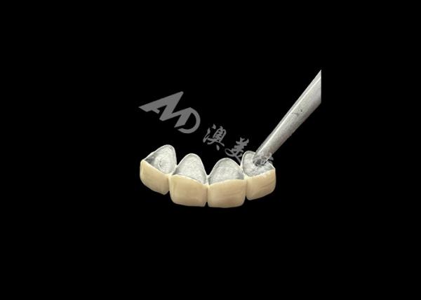 Quality Porcelain Fused to Metal Crown with Enhanced Corrosion Resistance for sale
