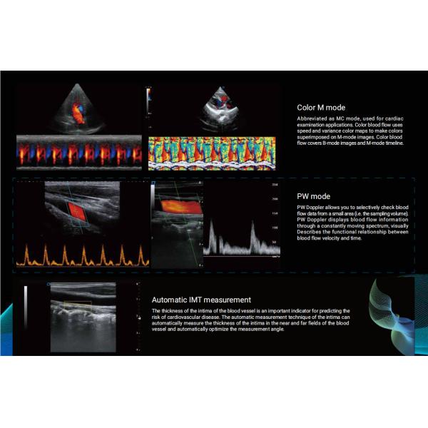 3D 4D 5D Vascular Medical Ultrasound Instruments Portable Color Doppler Ultrasound