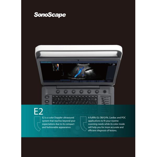 MSK Ultrasound TDI CW Color Sonoscape E2 E3 & Sonoscape E1 Usg