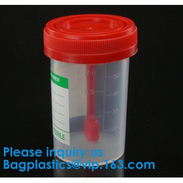 Disposable Urine Specimen Cup/Urine Sample Containers/Urine Collection Cup,Sterile Disposable Hospital Sample 60ml 100