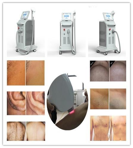 Quality 3 wavelength 755 808 1064 diode laser /lightsheer diode laser/ Beijing Nubway Ice xl platinum hair removal Price for sale