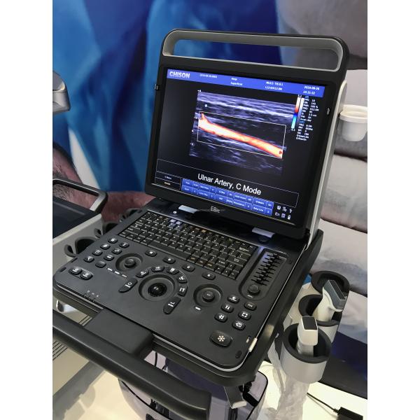 Portable 3D 4D Color Doppler USG&Sonoscape S9