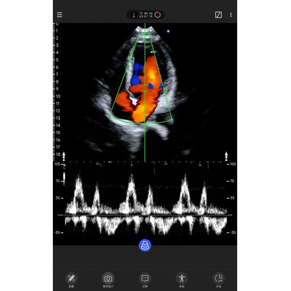 Depth 18.9cm Handheld Ultrasound Scanner For Iphone 3.6MHz