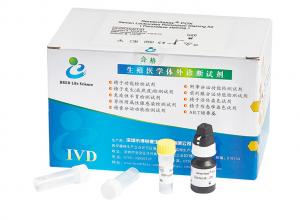 China Semen Sample Leukocytes Test Kit 40T/Kit For Male Reproductive Tract Infection Screening on sale