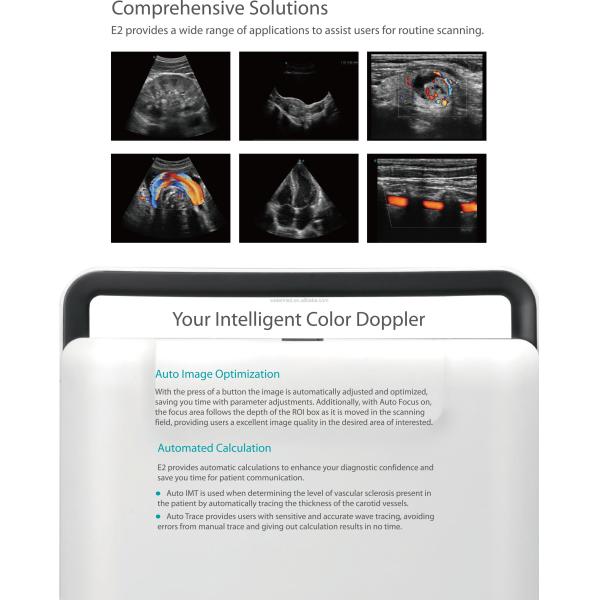 MSK Ultrasound TDI CW Color Sonoscape E2 E3 & Sonoscape E1 Usg