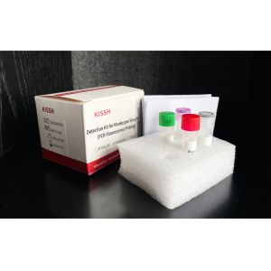 China Infectious Disease Monkeypox Virus PCR Detection Kit CE Certified wholesale