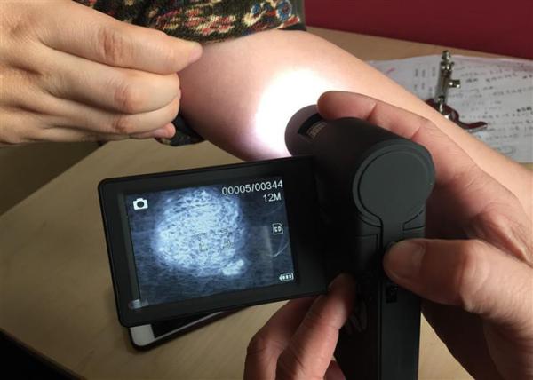 Quality Handheld Dermatoscope Digital Skin Analyzer 5M Pixels Supported PC of Window System for sale