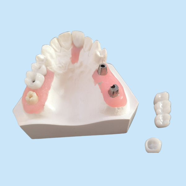 Good Biological Inter Miscibility Dental Implant Bar With FDA Approval
