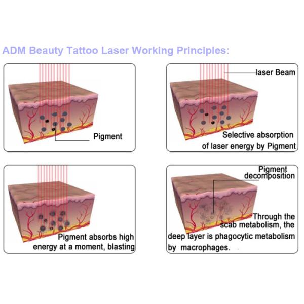 Portable Multifunctional Beauty Machine Q Switch Nd Yag Laser With IPL SHR Functions