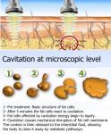 32KHZ 80K Ultrasound Cavitation Slimming Machine Tripolar Radio Frequency