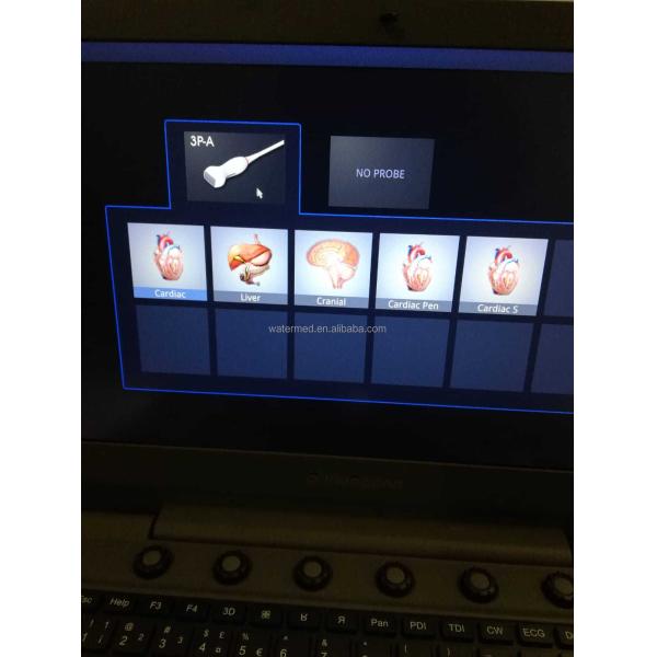 MSK Ultrasound TDI CW Color Sonoscape E2 E3 & Sonoscape E1 Usg