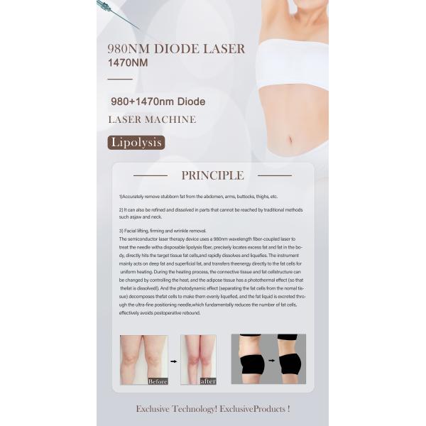 Desktop Style Hemorrhoids Treatment Portable Endolaser Evlt 980 with 1470 Endolifting Gomecy Facial Laser Diode Machine