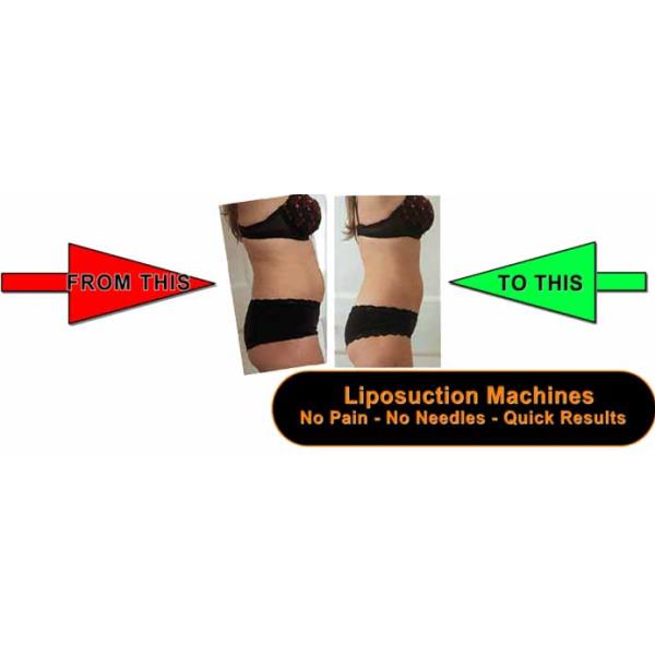 5 In 1 Cavitation RF Slimming Machine , Ultrasonic Anti Cellulite Massager Lose Weight Machine