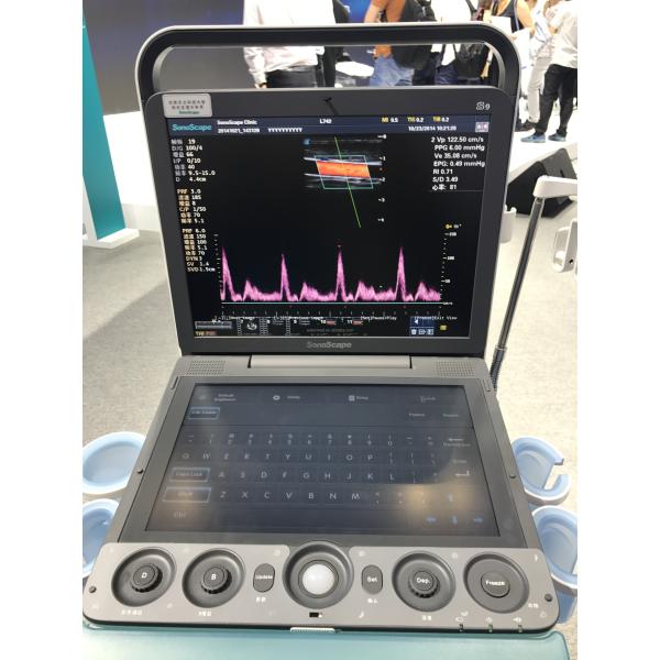 Portable 3D 4D Color Doppler USG&Sonoscape S9