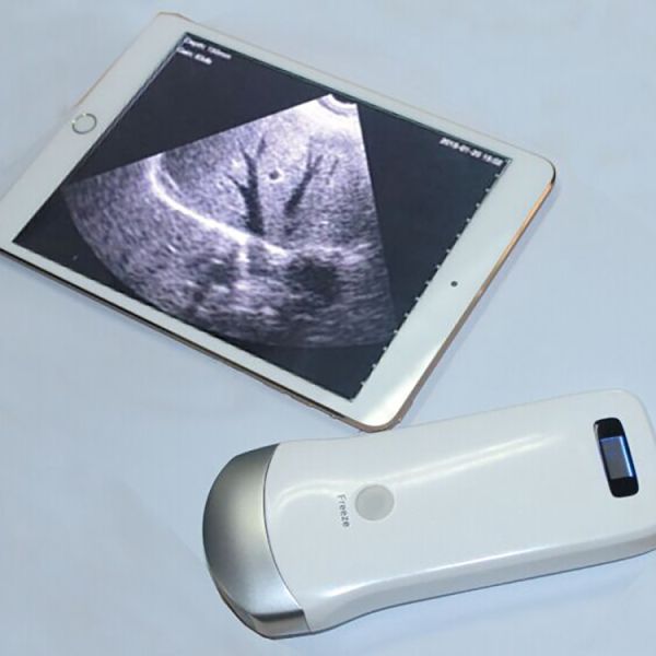 Mini Wireless Ultrasound Machine Probe Wifi Ultrasound Probe
