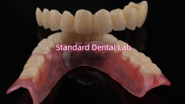 Quality Highly Durable And Natural-Looking Layered Porcelain For Layered Dental Zirconia Crown China Dental Lab for sale