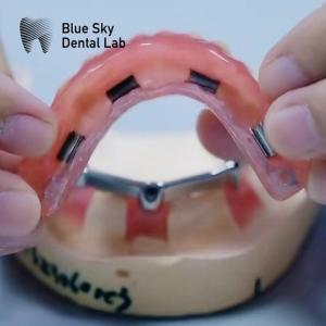 China Acrylic Denture Dental Titanium Bar With Attachments Silver And Gold wholesale