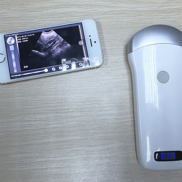 Mini Wireless Ultrasound Machine Probe Wifi Ultrasound Probe
