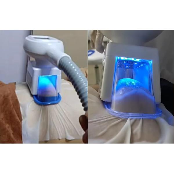 3 Size Vacuum Cool Cryolipolysis Fat Freezing Body Sculpting Slimming Machine