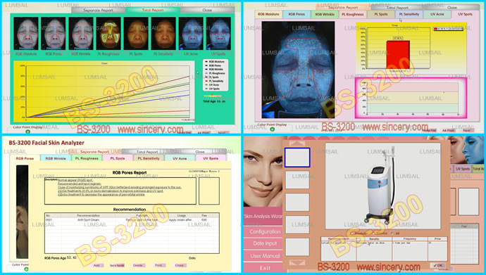 8800 Lux Skin Analysis Machine / Hair And Skin Analyzer For Dermal Skin Analysis