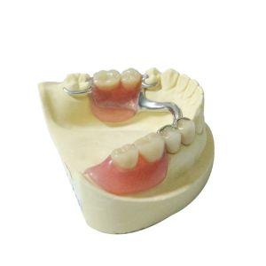 China Healthy Materials Denture Dental Lab Removable Partial Dentures custom made wholesale