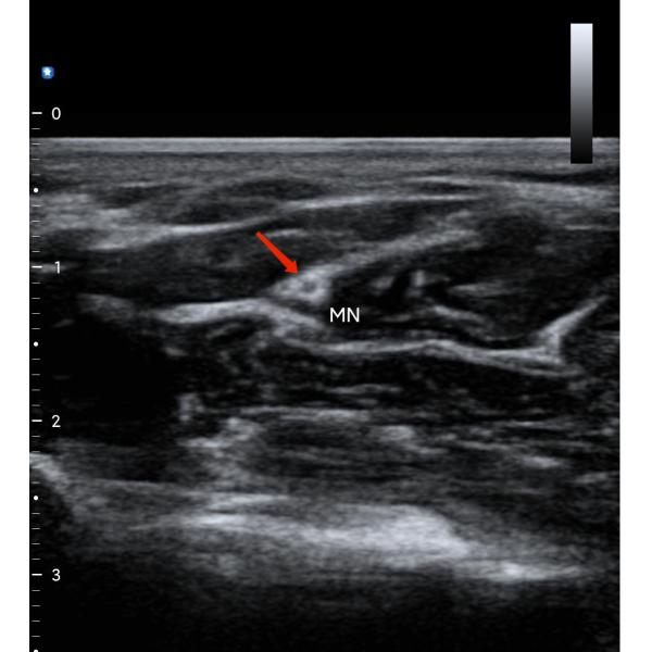 12.6cm Portable Color Doppler Ultrasound Scanner For Healthcare Professionals
