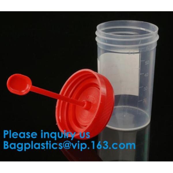 Disposable Urine Specimen Cup/Urine Sample Containers/Urine Collection Cup,Sterile Disposable Hospital Sample 60ml 100