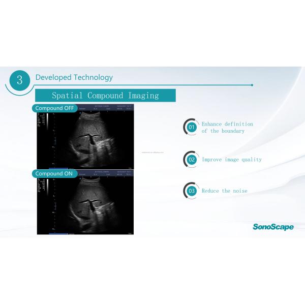 MSK Ultrasound TDI CW Color Sonoscape E2 E3 & Sonoscape E1 Usg