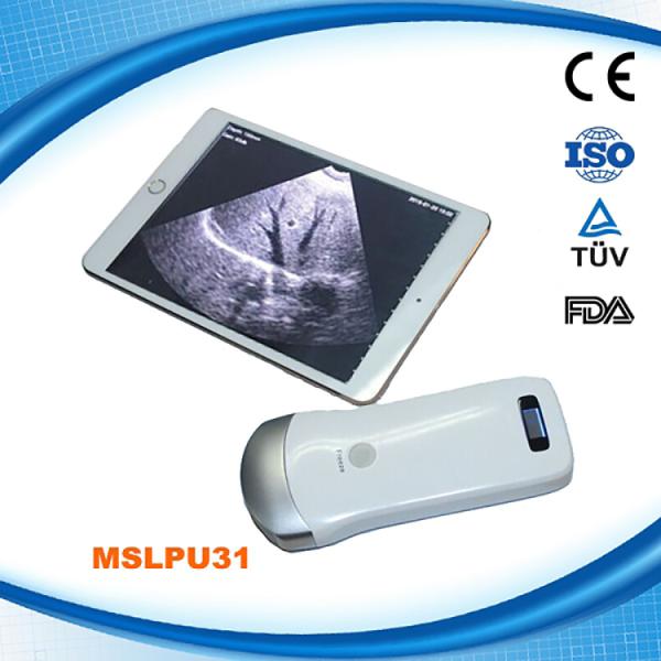 Mini Wireless Ultrasound Machine Probe Wifi Ultrasound Probe