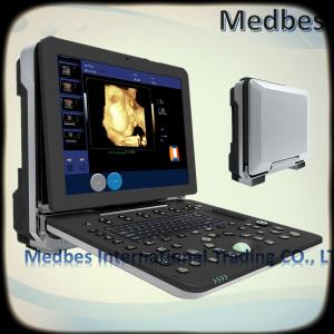 China 4D Color Doppler Ultrasound Diagnosis System 4D Color Digital Portable Cardiac Ultrasound Scanner wholesale