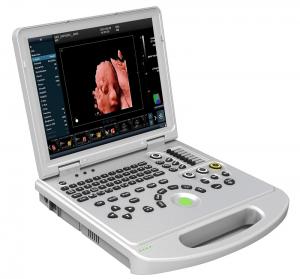 China CE 3D 4D 5D Portable Color Doppler Ultrasound Machine Scanner OEM wholesale
