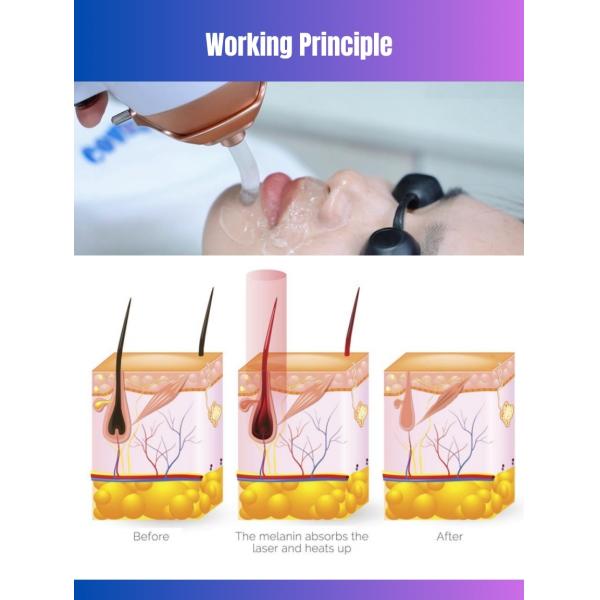 755 808 940 1064nm Diode Laser Hair Removal Device 4 Wavelength with 12*24mm/12*28mm Spot Size