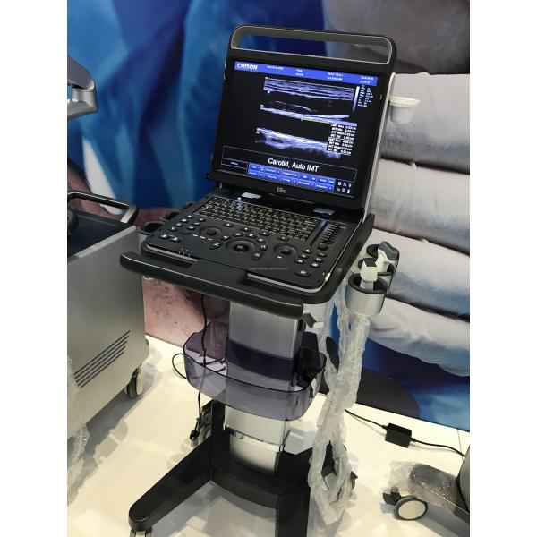 Portable 3D 4D Color Doppler USG&Sonoscape S9