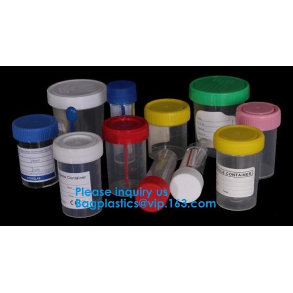 Disposable Urine Specimen Cup/Urine Sample Containers/Urine Collection Cup,Sterile Disposable Hospital Sample 60ml 100