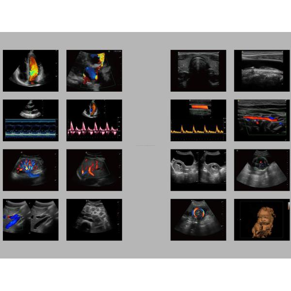 Portable 3D 4D Color Doppler USG&Sonoscape S9