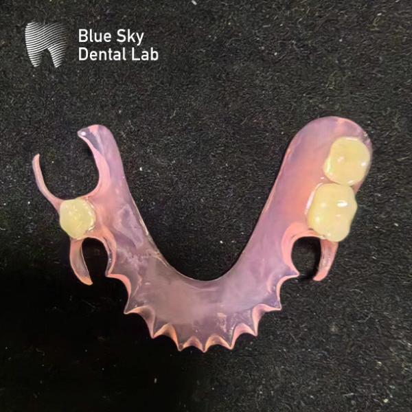 Customize Removable Acrylic Partial Denture Natural Looking Valplast Dental Partials