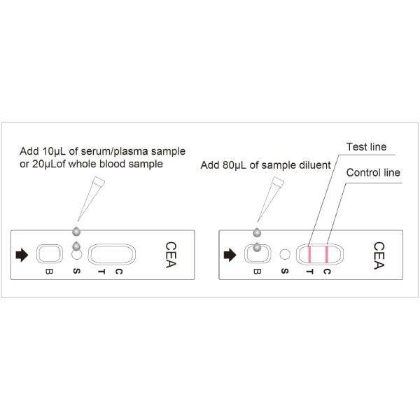 CEA Home Cancer Testing Kit