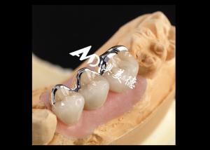 Strong PFM Porcelain Fused To Metal Crown Excellent Biocompatibility Wear Resistance