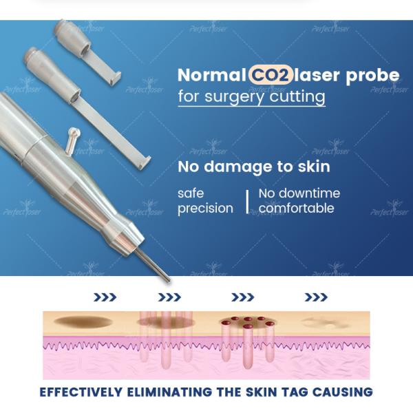 Vertical Femilift Surgery Co2 Fractional Laser Wrinkle Removal Skin Rejuvenation Vaginal Skin Tightening Machine