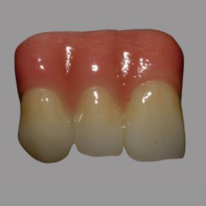 Buy cheap CAD / CAM Dental Layered Zirconia Bridge With Pink Porcelain from wholesalers