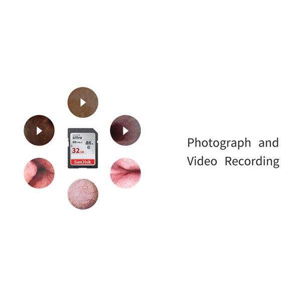 Flexible Video Ureteroscope Urological