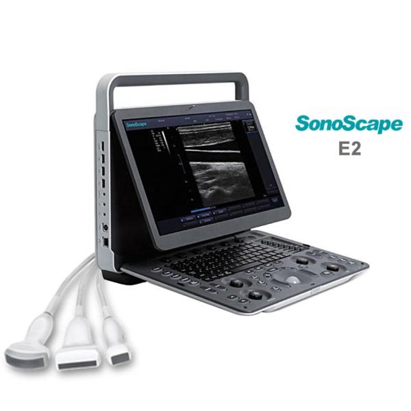 MSK Ultrasound TDI CW Color Sonoscape E2 E3 & Sonoscape E1 Usg
