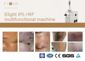 China Multifunctional SHR IPL Elight Hair Removal Machine 640nm 40 X 10mm Handle Spot wholesale