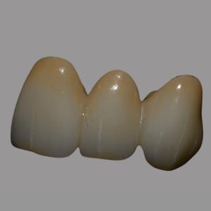 Buy cheap Natural Full Contour Zirconia Bridge Single Unit / Multiunit Wear Resistant from wholesalers
