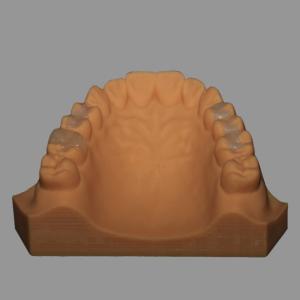 China Full Ceramic Dental Emax Inlay Onlay Crown Pressed / Milled wholesale