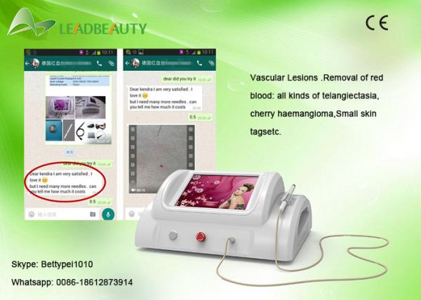 Quality Big promotion!!!Rbs vascular spider veins removal/varicose veins removal/spider veins vascular for sale