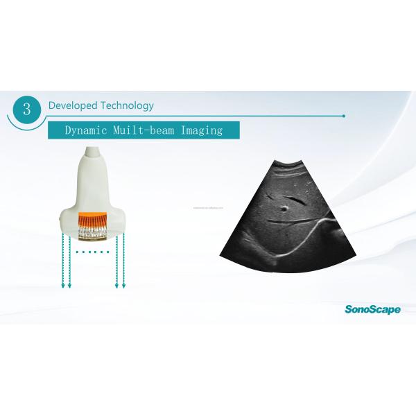 MSK Ultrasound TDI CW Color Sonoscape E2 E3 & Sonoscape E1 Usg