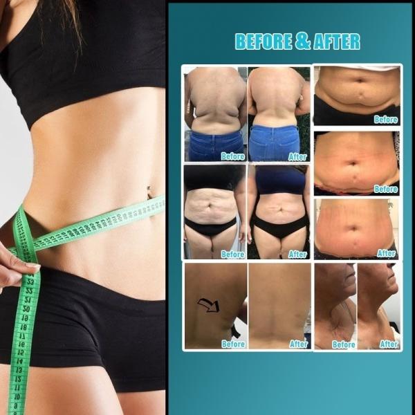 Vacuum Roller Vela Slimming Machine Weight Loss & Body Sculpting